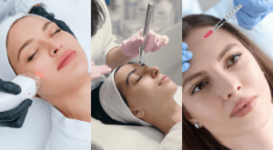 Three stages of a non-surgical facial treatment, from consultation through to the finished result