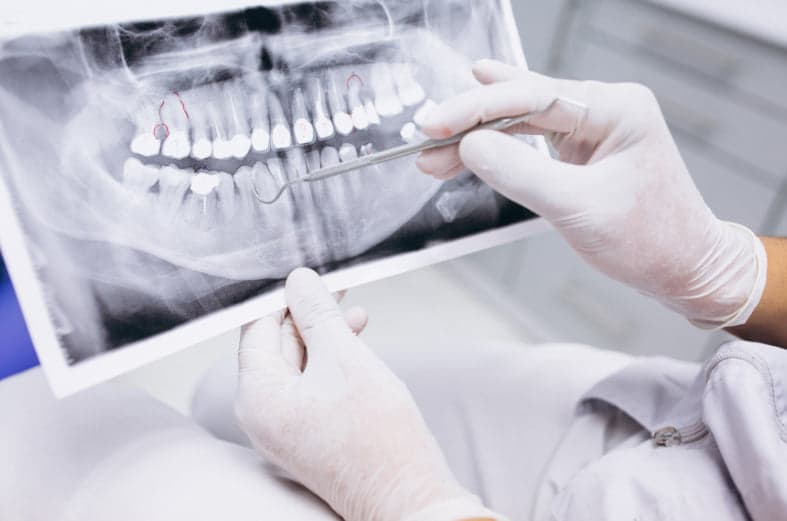 Two clinicians examining a panoramic dental X-ray