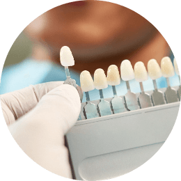 A dentist selecting the right shade from a guide to match an implant to a patient's teeth