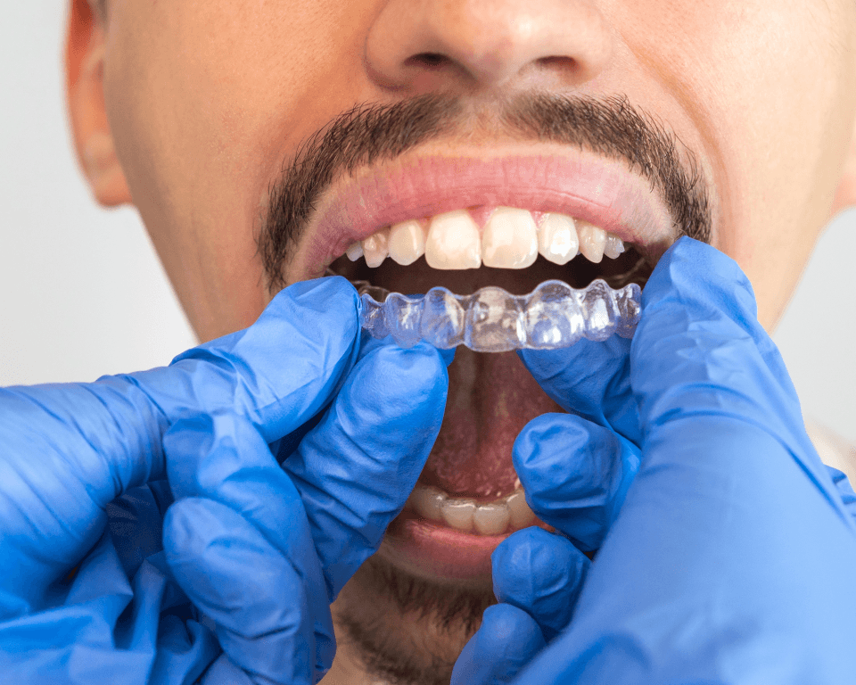 A clinician fitting a clear aligner tray to a patient's teeth